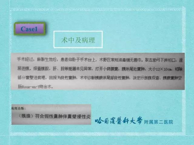 【病例】胰腺假性囊肿1例CT及MR影像表现