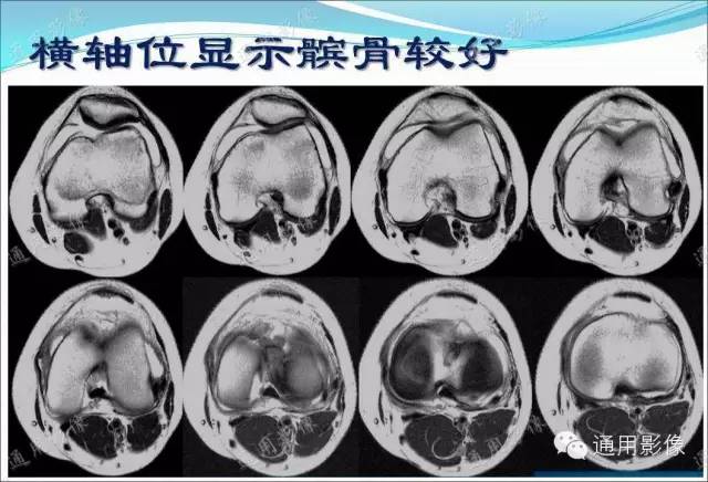 【PPT】骨关节序列临床应用
