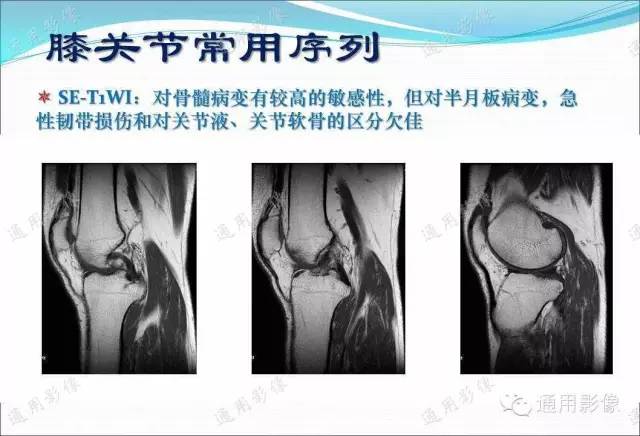 【PPT】骨关节序列临床应用