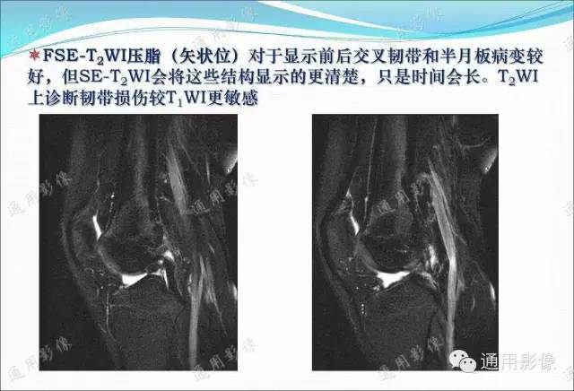 【PPT】骨关节序列临床应用