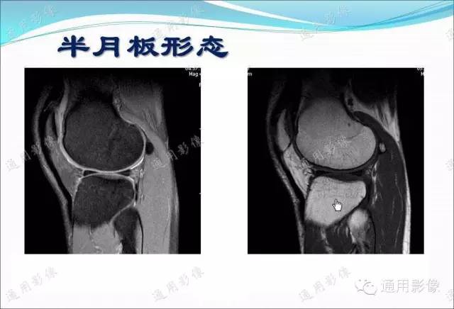 【PPT】骨关节序列临床应用