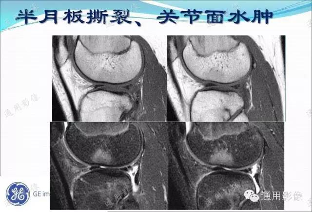 【PPT】骨关节序列临床应用