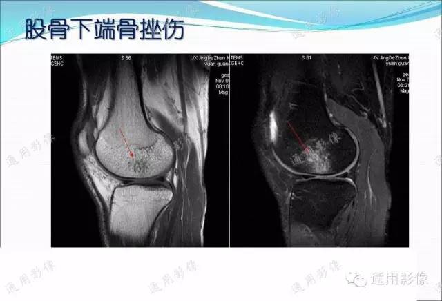 【PPT】骨关节序列临床应用