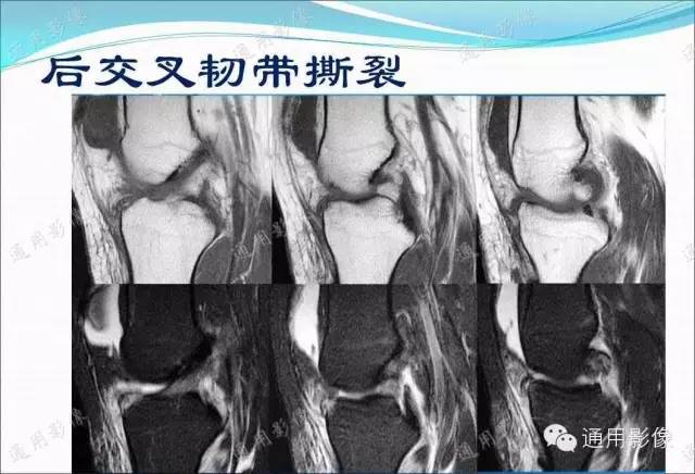 【PPT】骨关节序列临床应用