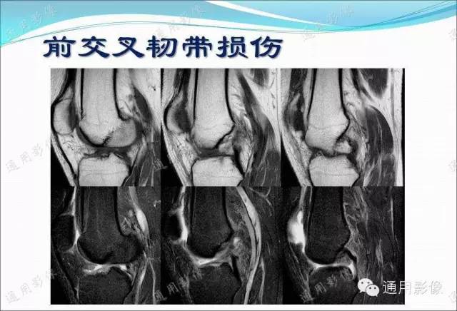 【PPT】骨关节序列临床应用