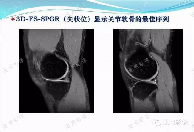 【PPT】骨关节序列临床应用