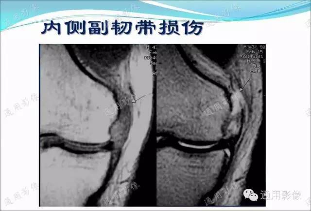 【PPT】骨关节序列临床应用