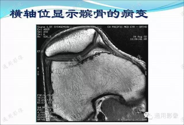 【PPT】骨关节序列临床应用