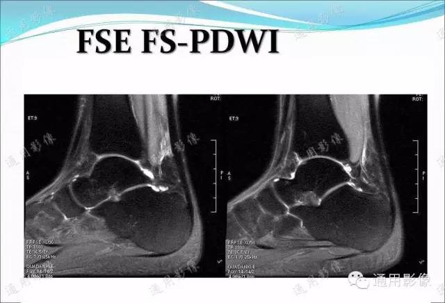 【PPT】骨关节序列临床应用