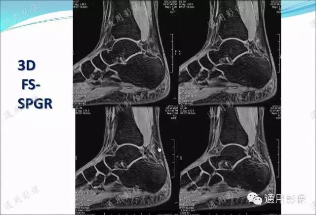 【PPT】骨关节序列临床应用