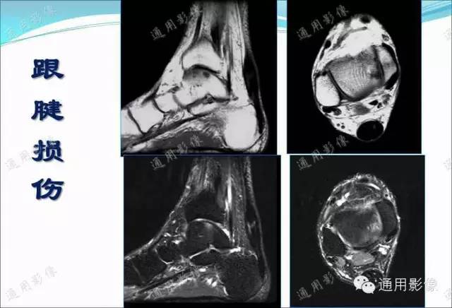 【PPT】骨关节序列临床应用