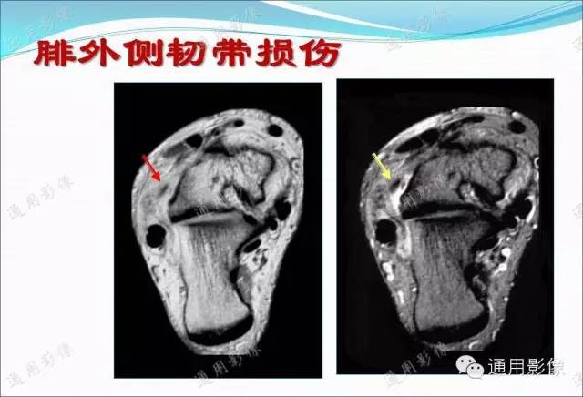 【PPT】骨关节序列临床应用