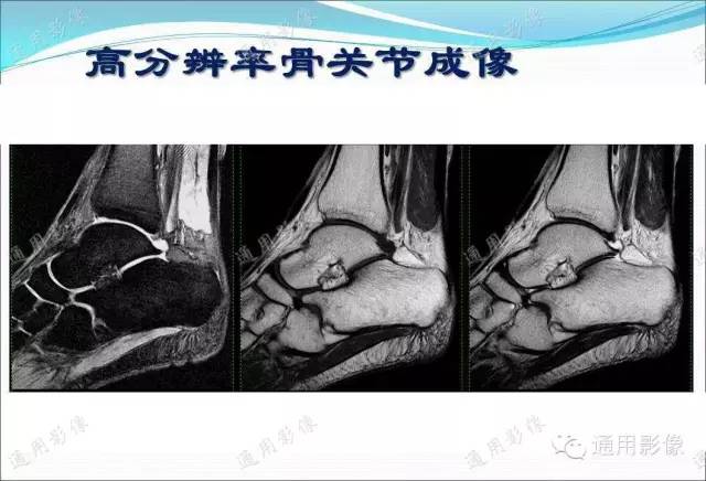 【PPT】骨关节序列临床应用