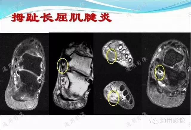 【PPT】骨关节序列临床应用