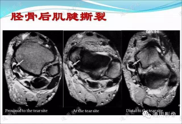 【PPT】骨关节序列临床应用