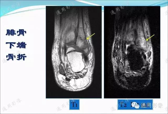 【PPT】骨关节序列临床应用