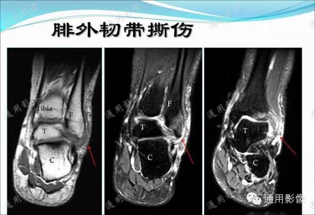 【PPT】骨关节序列临床应用