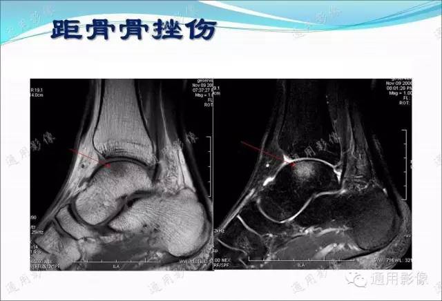 【PPT】骨关节序列临床应用