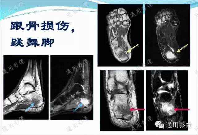 【PPT】骨关节序列临床应用