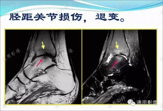 【PPT】骨关节序列临床应用