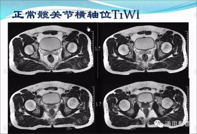 【PPT】骨关节序列临床应用