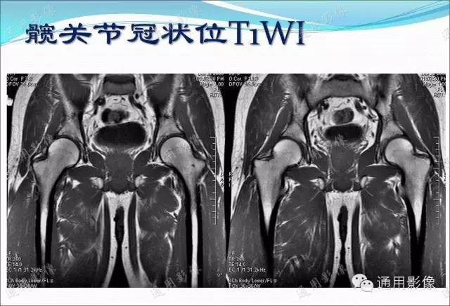 【PPT】骨关节序列临床应用