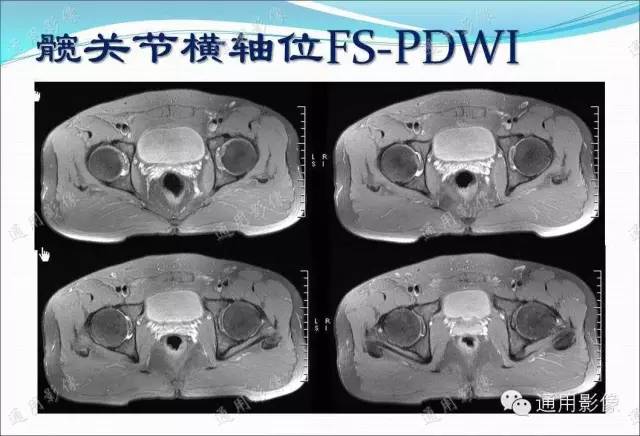 【PPT】骨关节序列临床应用