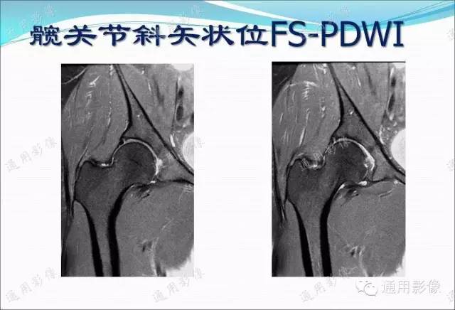 【PPT】骨关节序列临床应用