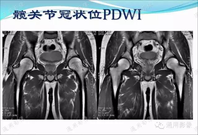 【PPT】骨关节序列临床应用