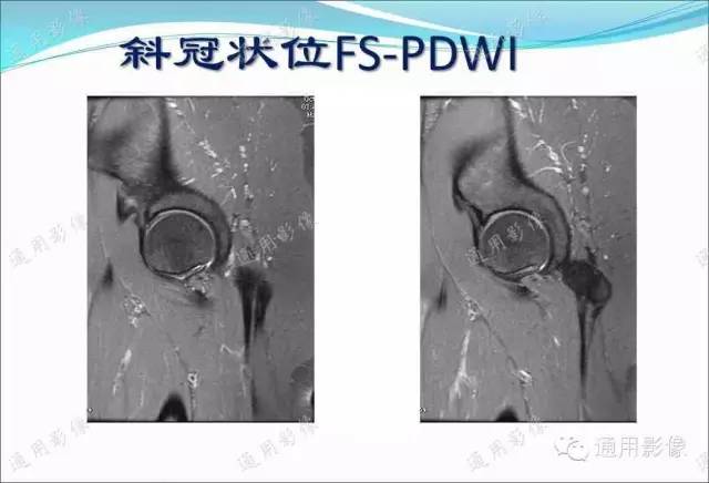 【PPT】骨关节序列临床应用