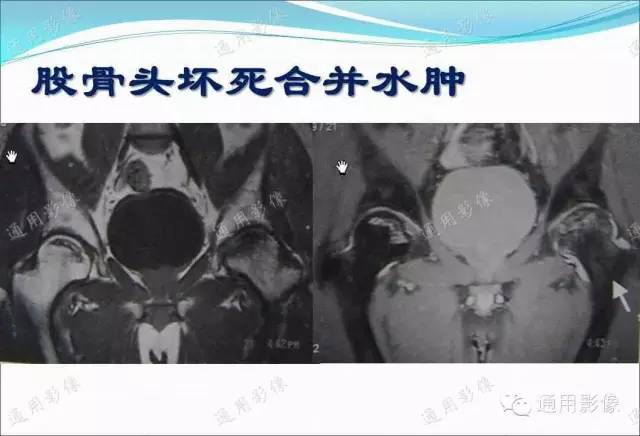 【PPT】骨关节序列临床应用