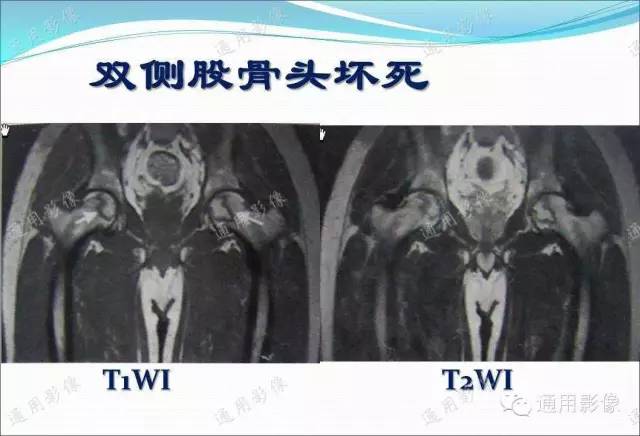 【PPT】骨关节序列临床应用