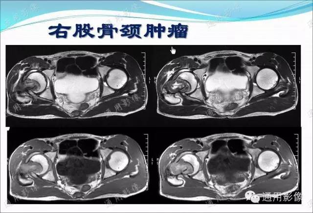 【PPT】骨关节序列临床应用