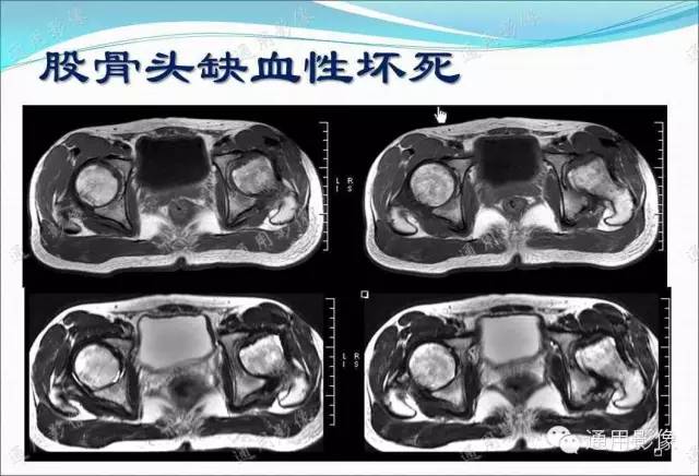 【PPT】骨关节序列临床应用