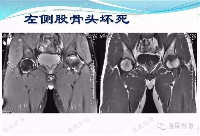 【PPT】骨关节序列临床应用