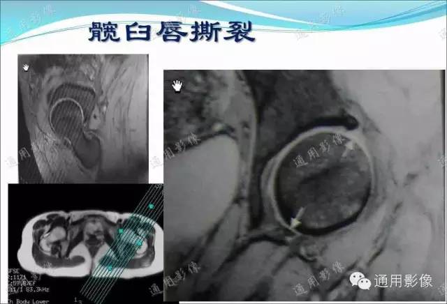 【PPT】骨关节序列临床应用