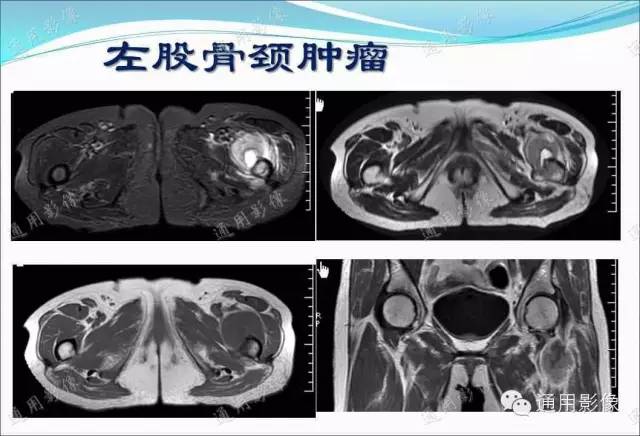 【PPT】骨关节序列临床应用