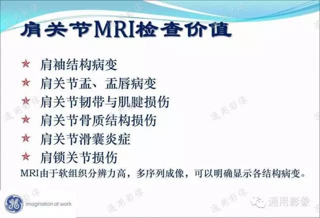 【PPT】骨关节序列临床应用