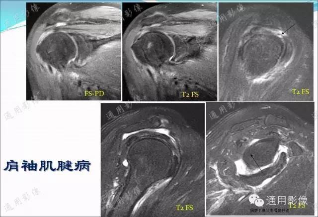 【PPT】骨关节序列临床应用