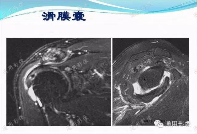 【PPT】骨关节序列临床应用