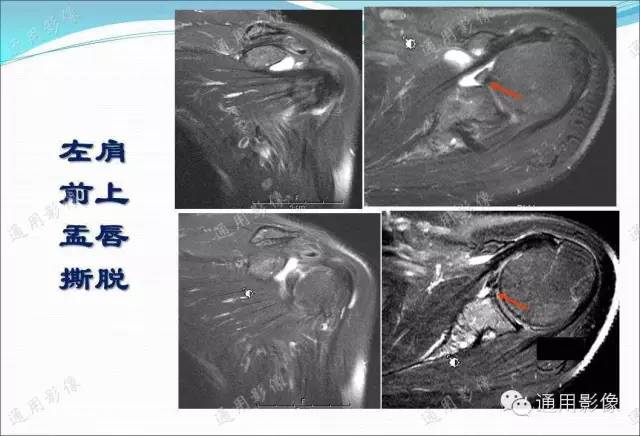 【PPT】骨关节序列临床应用