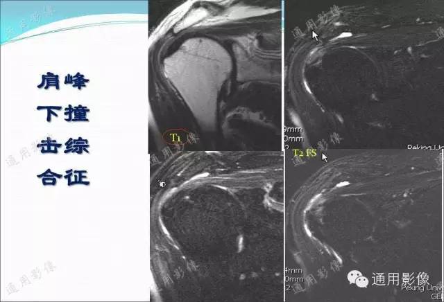 【PPT】骨关节序列临床应用