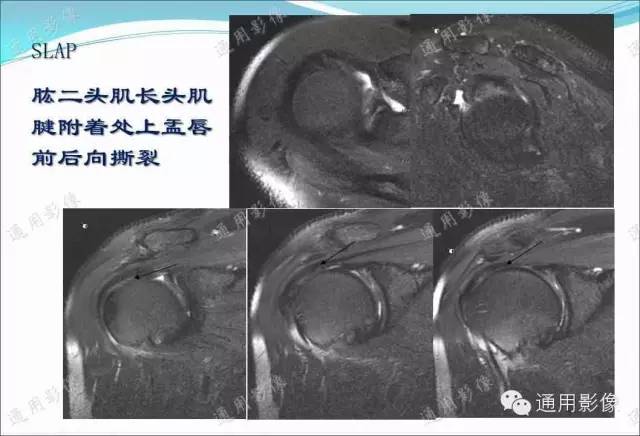 【PPT】骨关节序列临床应用