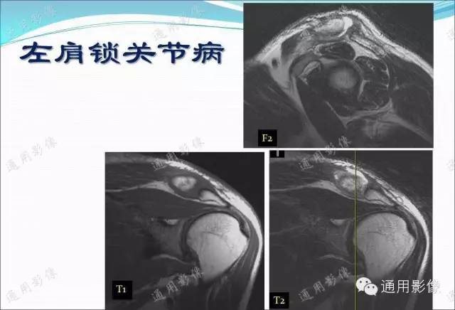 【PPT】骨关节序列临床应用