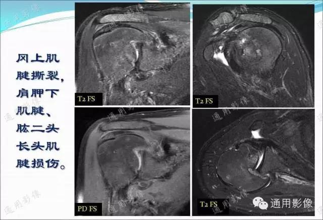 【PPT】骨关节序列临床应用