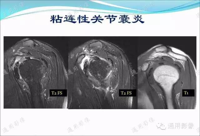 【PPT】骨关节序列临床应用