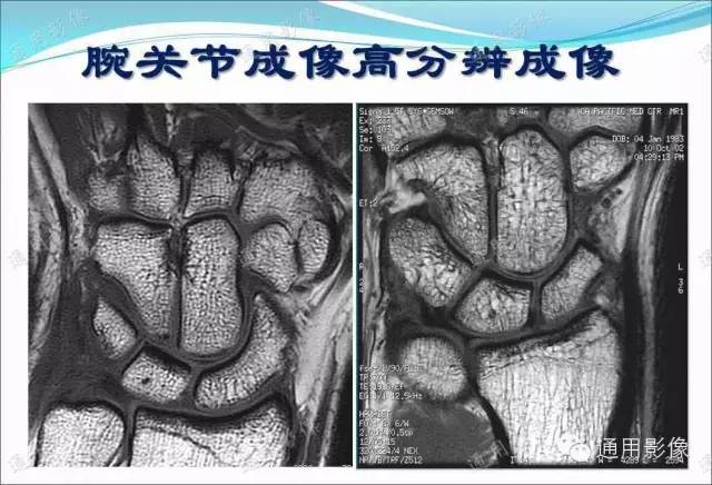 【PPT】骨关节序列临床应用