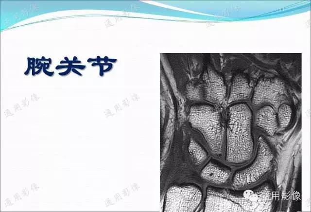 【PPT】骨关节序列临床应用