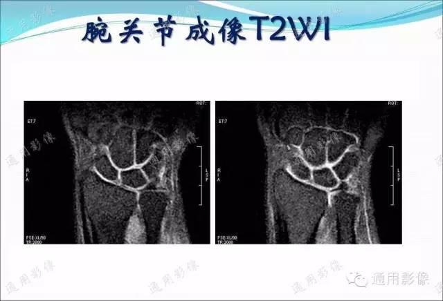 【PPT】骨关节序列临床应用