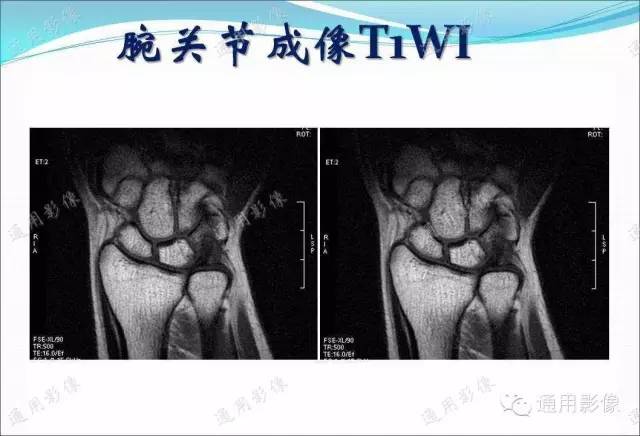 【PPT】骨关节序列临床应用